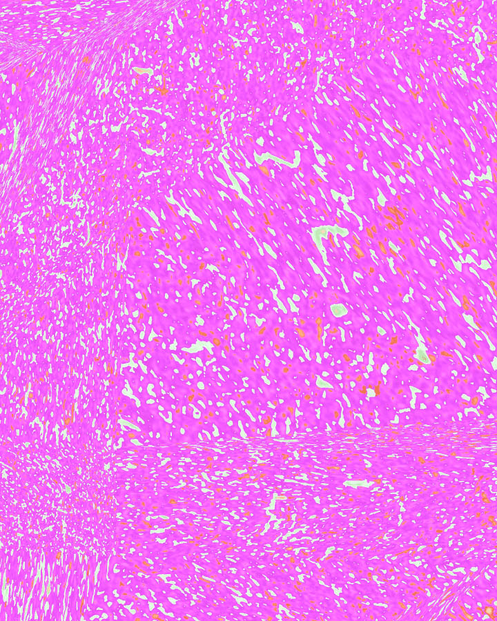 Sustainability initiative - Workers’ right